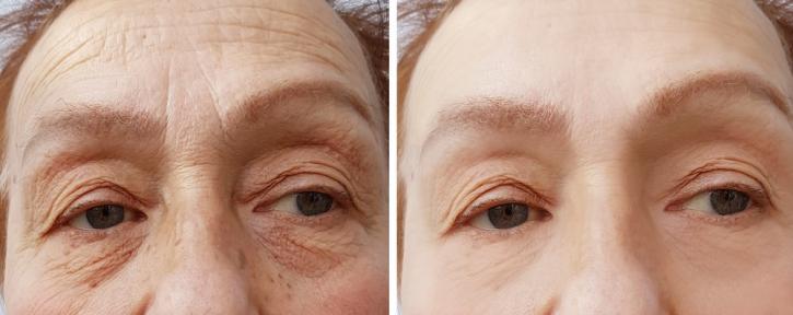 Image for Oakville Cosmetics - Botox + Dermal Fillers with ID of: 3588882