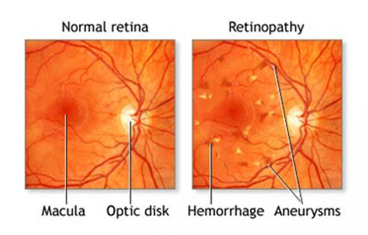 Image for Retina Specialist with ID of: 3606507