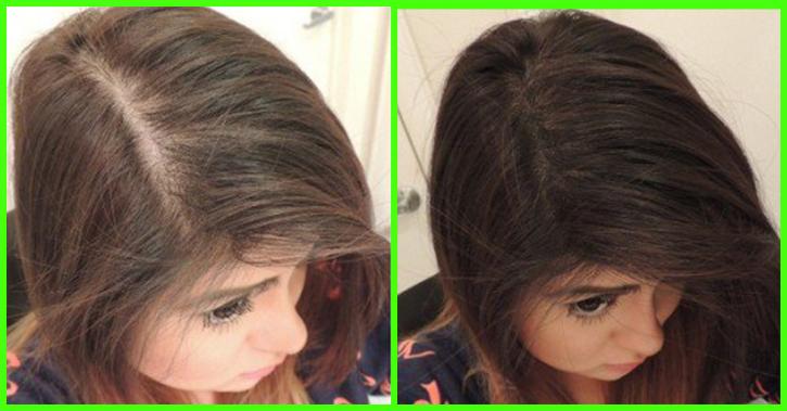 Image for How Does Work Hair Revival X? with ID of: 3609792