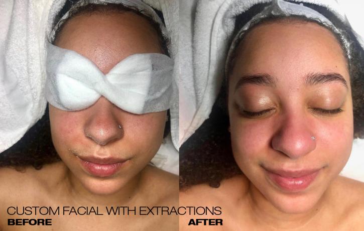 Image for Skin Spa New York - Back Bay with ID of: 3611653