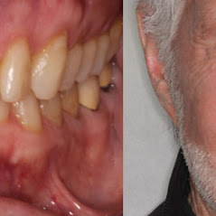 Image for Remarkable Smiles | Dr. Eric Jorgensen, DDS with ID of: 3614111
