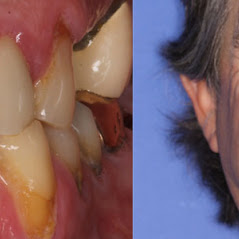 Image for Remarkable Smiles | Dr. Eric Jorgensen, DDS with ID of: 3614113