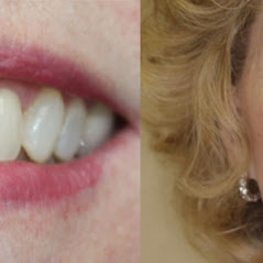 Image for Remarkable Smiles | Dr. Eric Jorgensen, DDS with ID of: 3614115