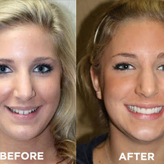 Image for Remarkable Smiles | Dr. Eric Jorgensen, DDS with ID of: 3614120