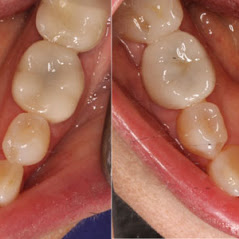 Image for Remarkable Smiles | Dr. Eric Jorgensen, DDS with ID of: 3614131