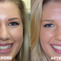 Image for Remarkable Smiles | Dr. Eric Jorgensen, DDS with ID of: 3614134