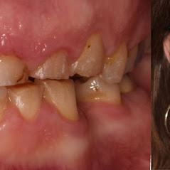 Image for Remarkable Smiles | Dr. Eric Jorgensen, DDS with ID of: 3614212