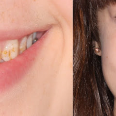 Image for Remarkable Smiles | Dr. Eric Jorgensen, DDS with ID of: 3614219