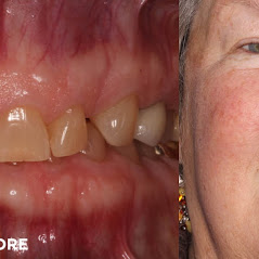 Image for Remarkable Smiles | Dr. Eric Jorgensen, DDS with ID of: 3614324