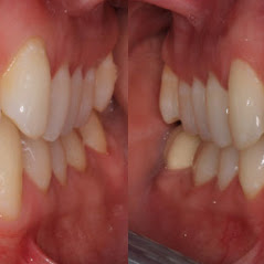 Image for Remarkable Smiles | Dr. Eric Jorgensen, DDS with ID of: 3614348