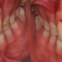 Image for Remarkable Smiles | Dr. Eric Jorgensen, DDS with ID of: 3614361