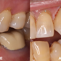 Image for Remarkable Smiles | Dr. Eric Jorgensen, DDS with ID of: 3614390