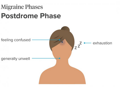 Image for migraine postdrome treatment with ID of: 3618180