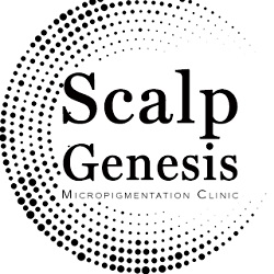Image for Scalp Genesis with ID of: 3628130