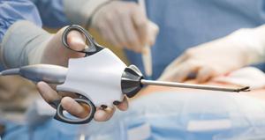 Image for Single-Use Medical Device Reprocessing Market Widespread Research and Fundamental study to 2026 with ID of: 3633859