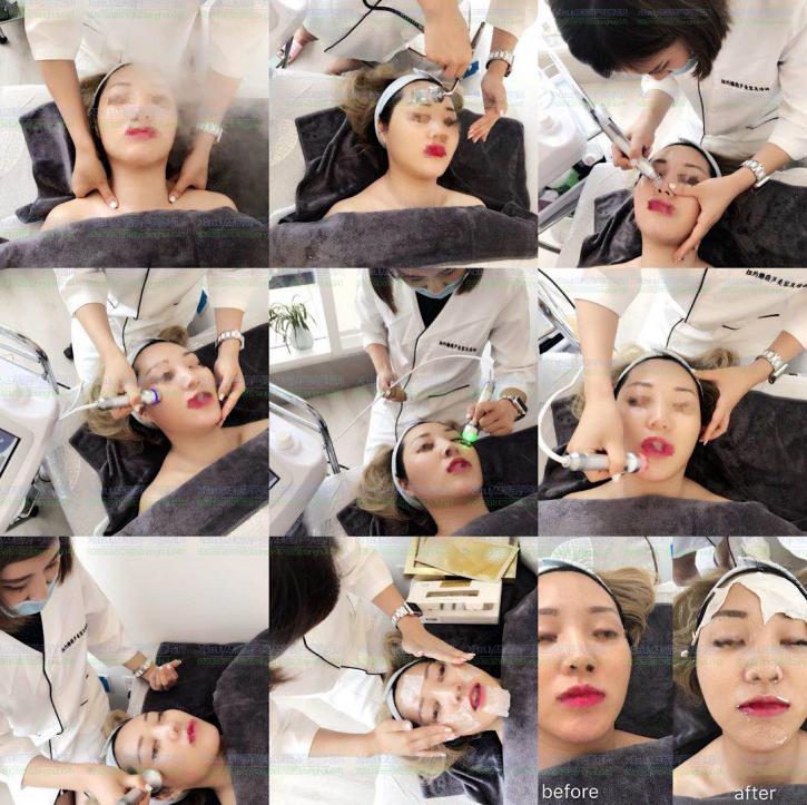 Image for X Beauty 29 with ID of: 3635766