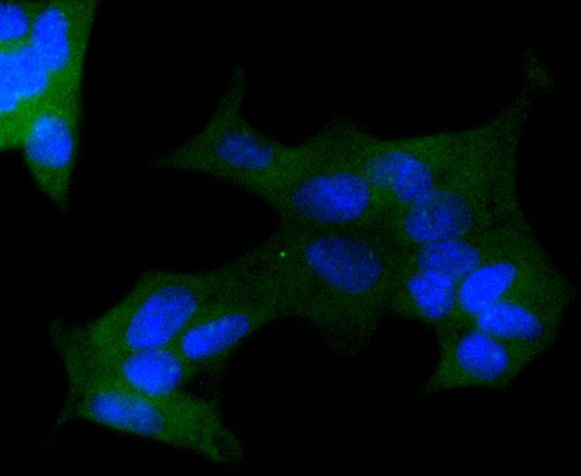 Image for anti cc1 antibody with ID of: 3657023