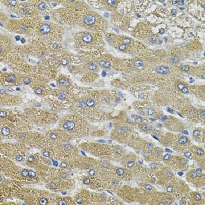 Image for aqp5 antibody with ID of: 3657028