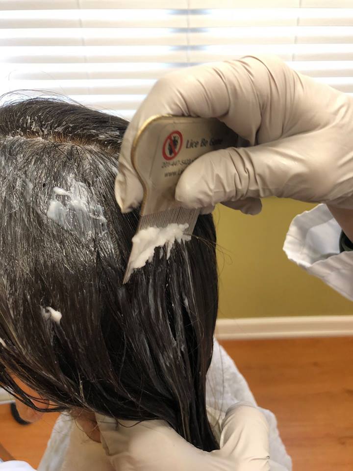 Image for Lice Be Gone with ID of: 3659975