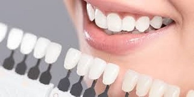 Image for Emergency Dentist Schenectady with ID of: 3671704
