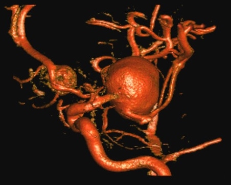 Image for David Newell, MD with ID of: 3672827