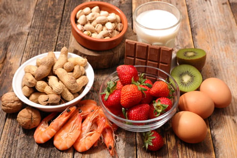 Image for Food Sensitivity Testing At EBL Naturopathic Clinic with ID of: 3675710