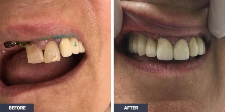 Image for Botox For Migraines with ID of: 3697294