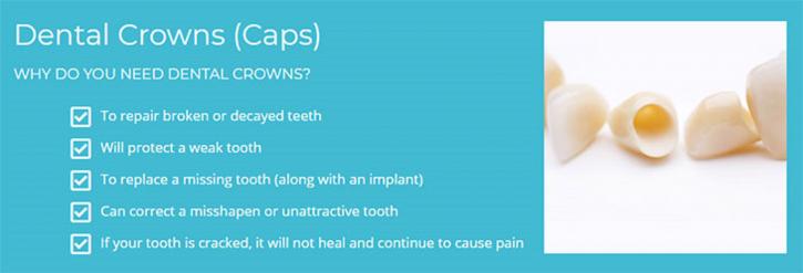 Image for All On 4 Dental Implants with ID of: 3697317