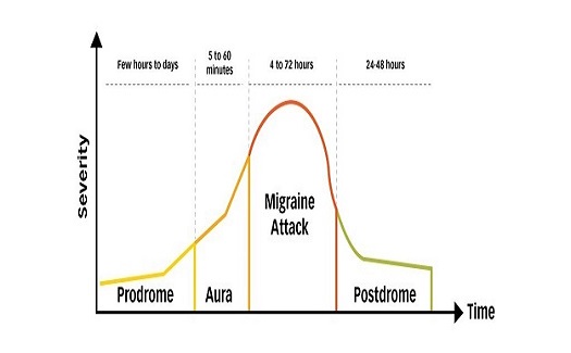 Image for Postdrome treatment with ID of: 3702403