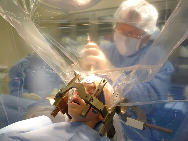 Image for Stereotactic Surgery Devices Market Size, Share, Growth and Trends Analysis Report, 2018 to 2025 with ID of: 3702802