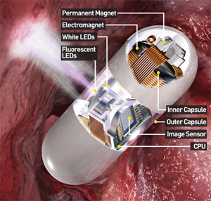 Image for Capsule Endoscopy System Market Report To, 2025 Product Scope, Growth Rate & Industry Outlook with ID of: 3709772