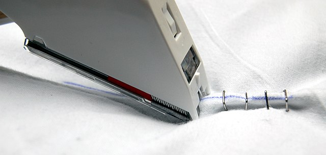 Image for Global Surgical Stapling Devices Market Size, Share, Growth, Trends and Industry Analysis Report, 2019 to 2026 with ID of: 3709850