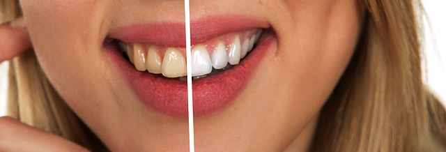 Image for Dental Rush with ID of: 3713528