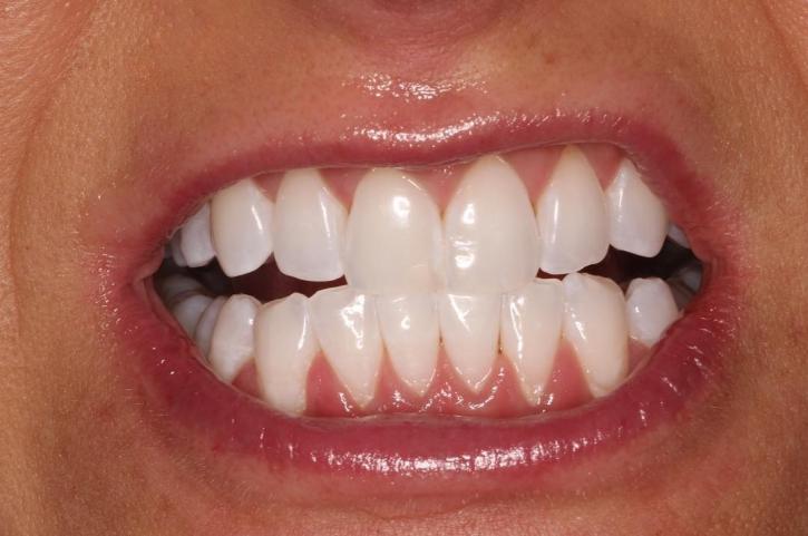 Image for Kruyer Dental with ID of: 3718512