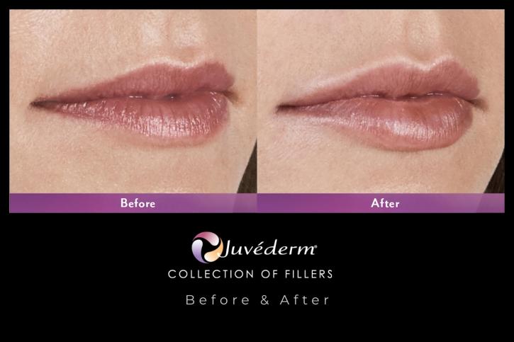 Image for Pure Lux Medspa with ID of: 3721787
