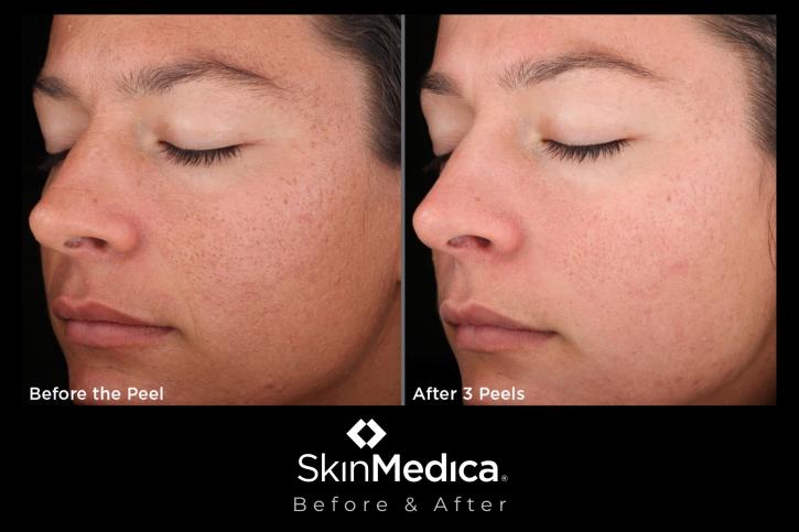 Image for Pure Lux Medspa with ID of: 3721801