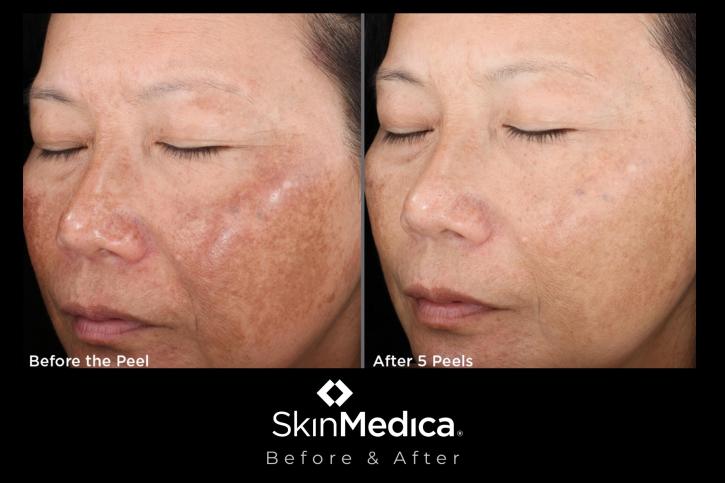 Image for Pure Lux Medspa with ID of: 3721827