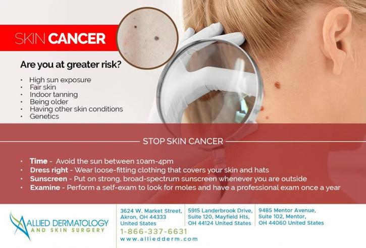 Image for Mohs Surgery Mayfield Heights OH with ID of: 3746027