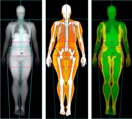Image for DEXA Plus with ID of: 3746477