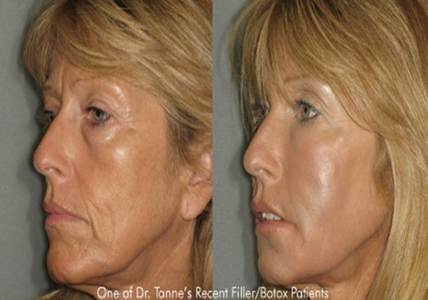 Image for Cosmetic Laser MD with ID of: 374741