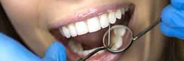 Image for Denture Implants with ID of: 3750813