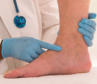 Image for Leg Vein Doctors with ID of: 3753319