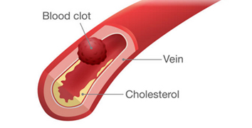 Image for Leg Vein Doctors with ID of: 3753321