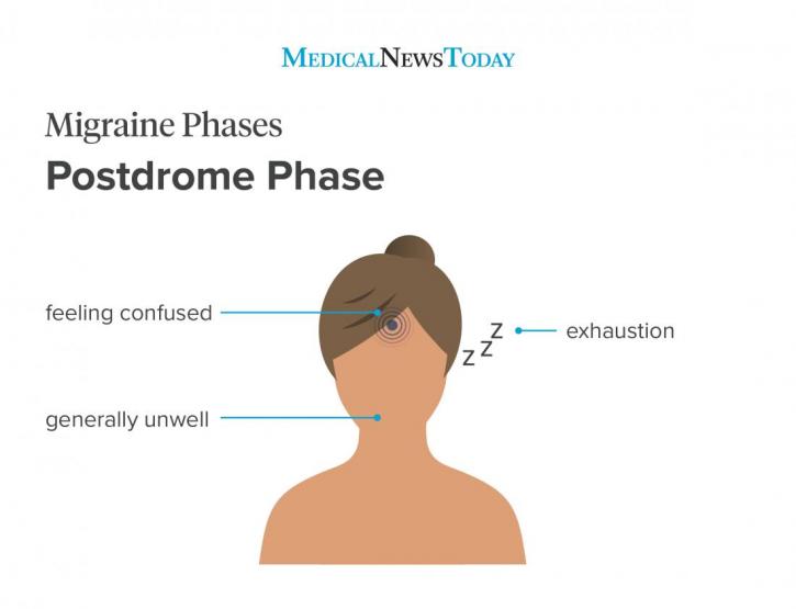 Image for Postdrome Treatment with ID of: 3762040
