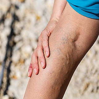 Image for Vein specialists with ID of: 3764780
