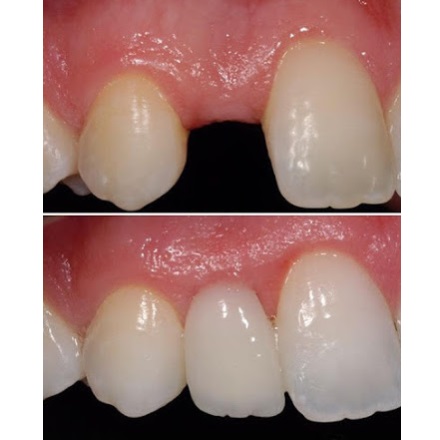 Image for The Dental Method Richardson with ID of: 3768611