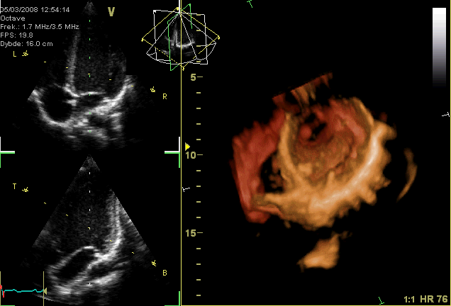 Image for Structural Heart Imaging (SHI) Market Size, Share, Growth, Trends and Forecast Report with ID of: 3770989
