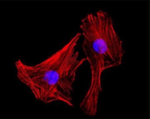 Image for bmp4 antibody with ID of: 3776919