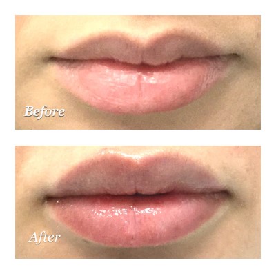 Image for Microdermabrasion Facial with ID of: 3782390