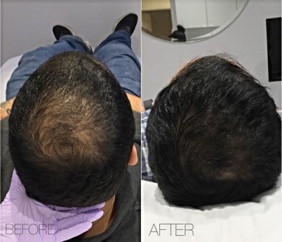 Image for Oxygen & Deep Cleaning Facial with ID of: 3791308
